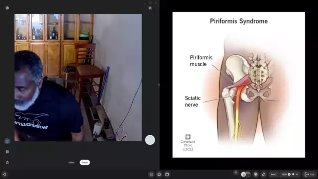 Ssc 6 glute med and piriformis